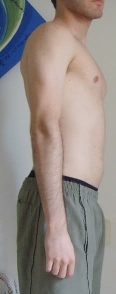 Hipertrofia1MsAtrs2.jpg