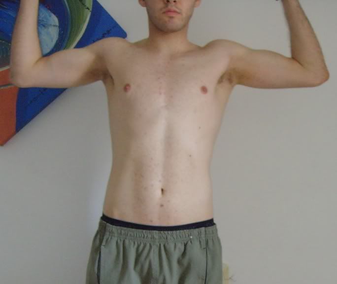 Hipertrofia1MsAtrs3.jpg