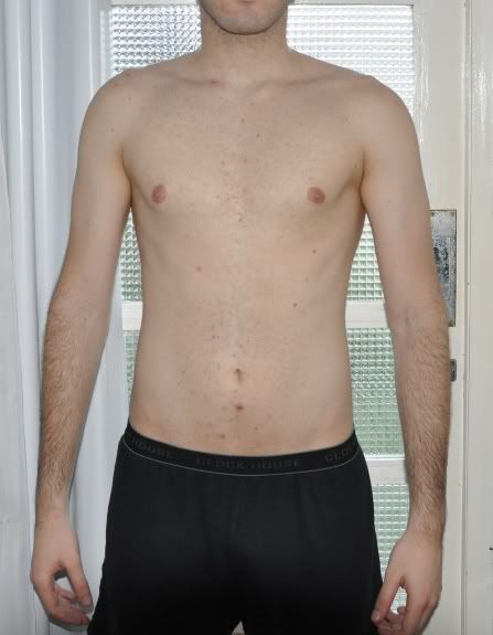 Hipertrofia4MesesAtrs1.jpg