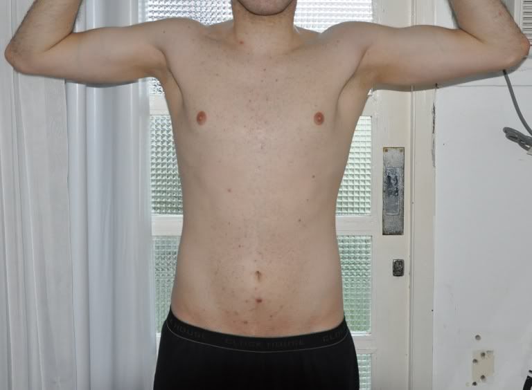Hipertrofia4MesesAtrs2.jpg